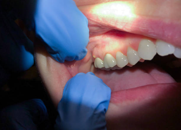 Best Weekend Emergency Dentist in Eastpointe, MI